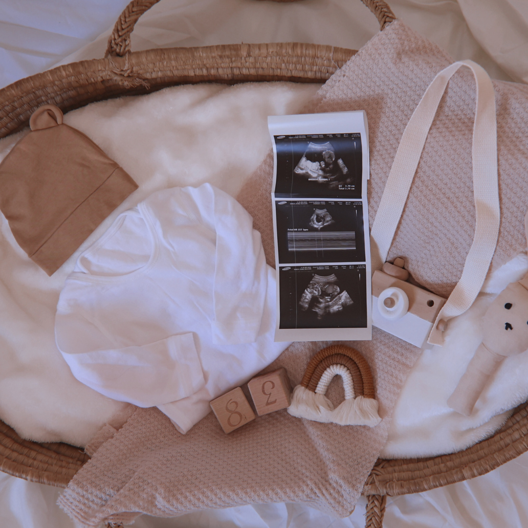The Ultimate Baby Checklist: Newborn Essentials to Buy Now – Sweet Dreamers